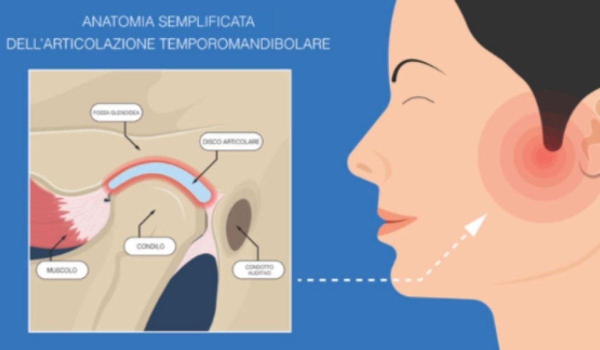 Gnatologia, Dolore Orofacciale e Bruxismo a Faenza - Studio ABG